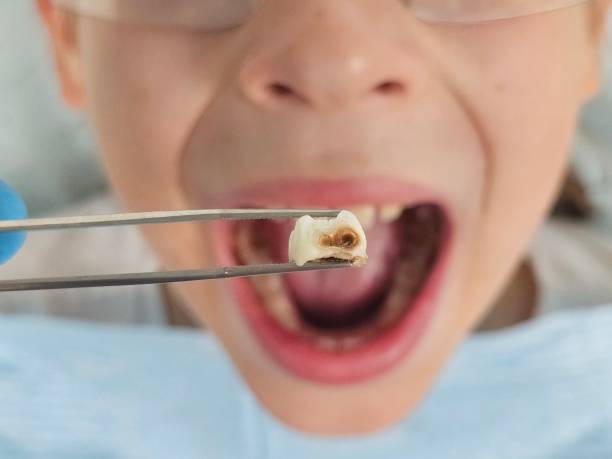 Best Pediatric Emergency Dentist in Keary, NE